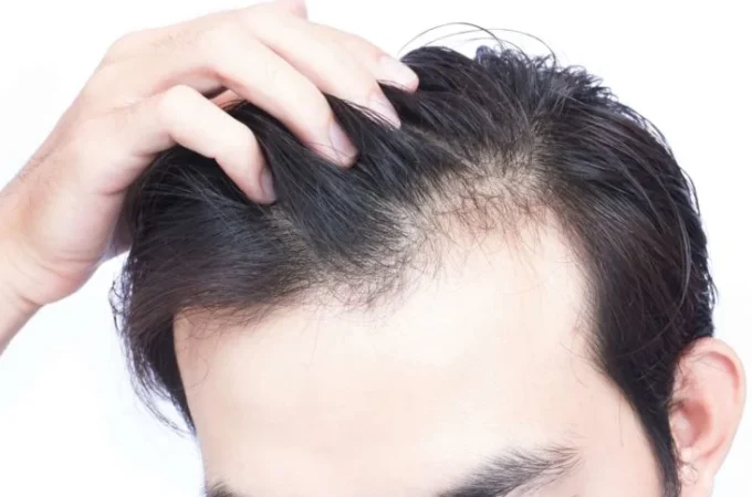 Natural Remedies To Aid Hair Loss
