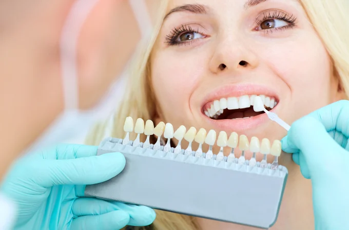 Secret To A Beautiful Smile: Teeth Whitening
